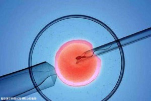 时差成像